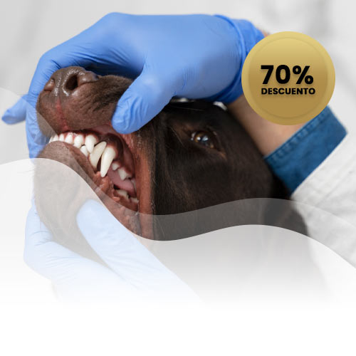 Limpieza Dental con 70% OFF